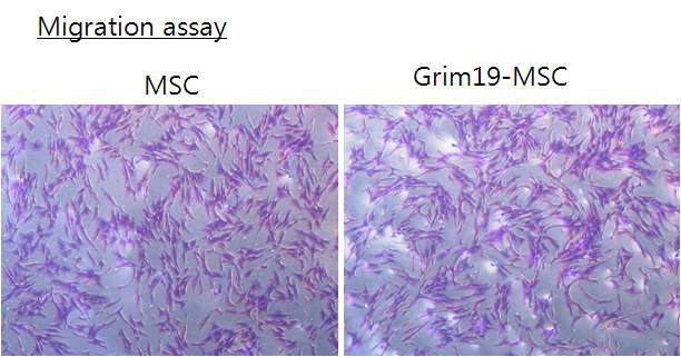 Grim19 유전자 도입된 중간엽줄기세포의 정상적인 migration property