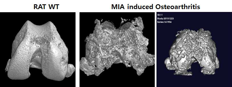 MIA 유도된 골관절염 마우스의 연골 파괴 (micro-CT)