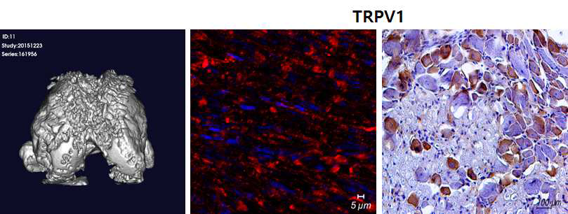 MIA 유도 골관절 마우스의 Dorsal root ganglia 내의 통증 인자 TRPV1의 발현 활성