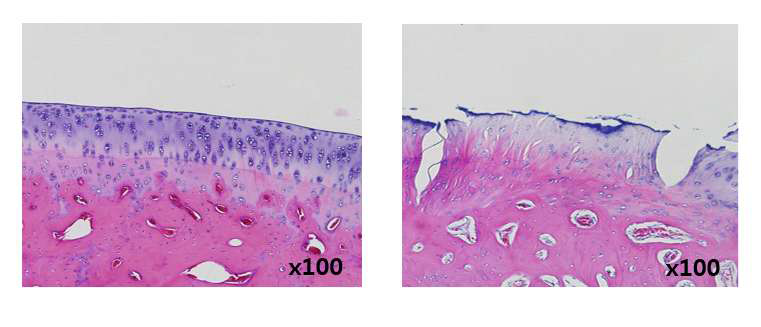 ligament와 반월상연골판 제거술 8주후의 Hematoxylin&Eosin 염색결과