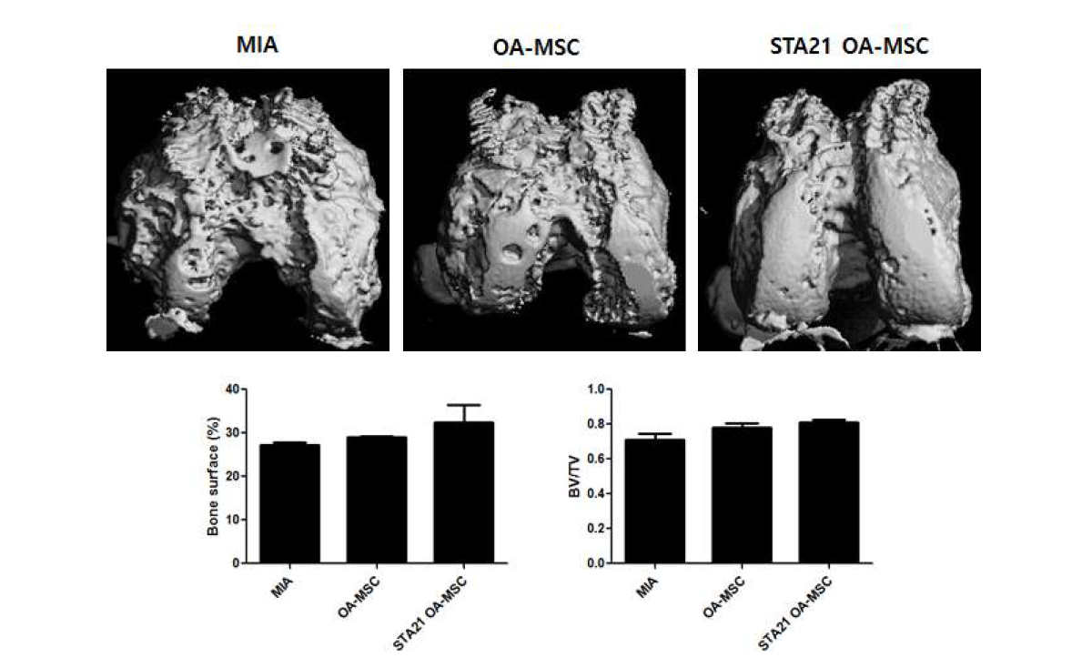 micro-CT 분석을 통한 STA21 OA-MSC의 골관절염 질환 억제 효력 확인