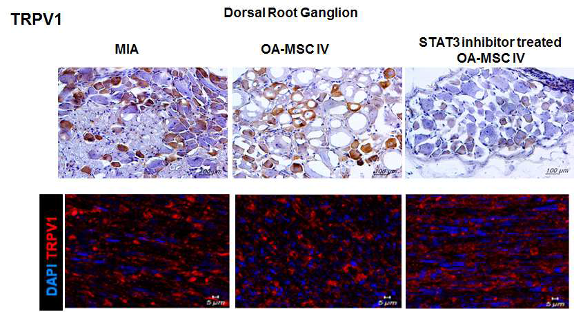 STA21 처리된 OA-MSC 혈관 주입에 의한 신경절 (Dorsal ganglion)내 통증인자 활성 억제