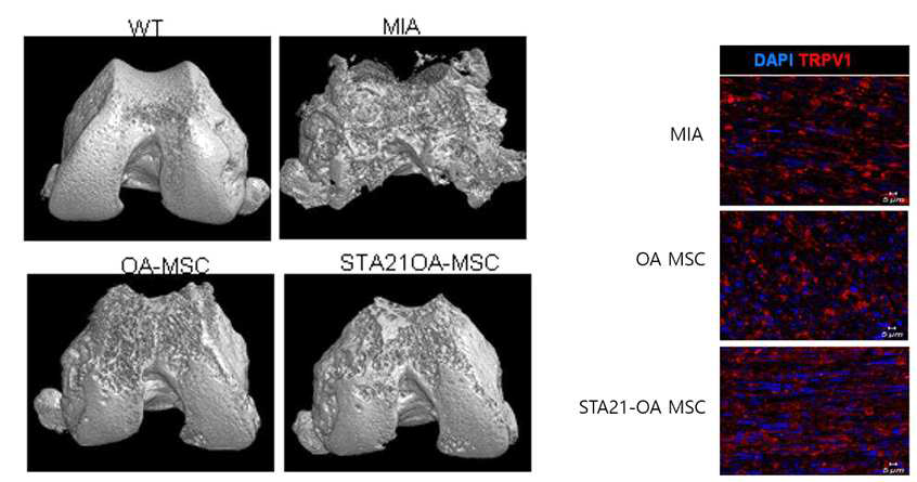 STA21 처리된 OA-MSC의 혈관 주입에 의한 연골 손상억제와 통증인자 활성 제어 효력