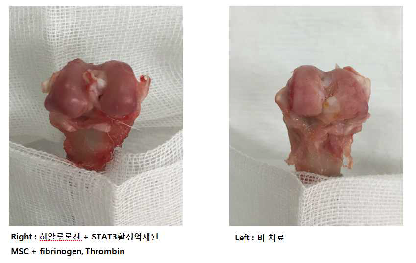 비 처치군과 확립된 혼합비의 환자유래 STAT3 활성억제 MSC 주입군의 육안적 관찰