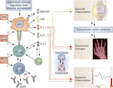 Pathology of Rheumatoid Arthritic disease, Nat. Rev. Rheumatol. 2009