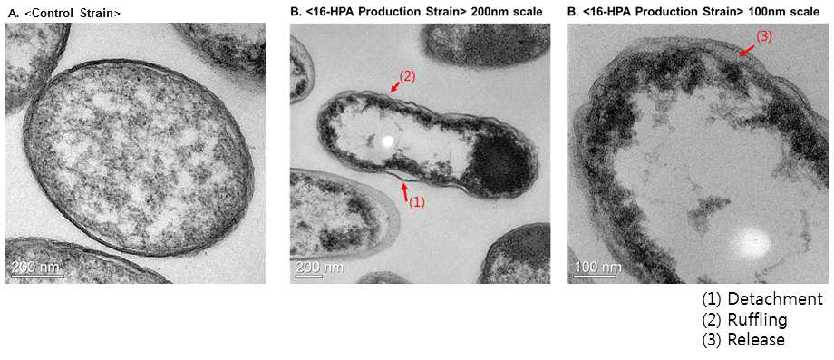 투과전자현미경을 통해 확인한 오메가-수산화 지방산 생산 세포 형태 비교