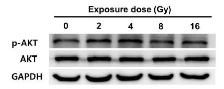 AKT의 인산화에 대한 양성자빔의 영향