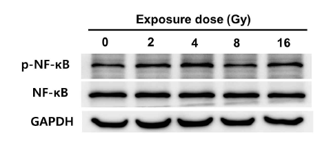 NF-κB의 인산화에 대한 양성자빔의 영향
