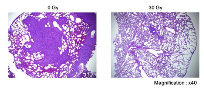 양성자빔 30 Gy 단회조사에 의한 폐 전이 억제
