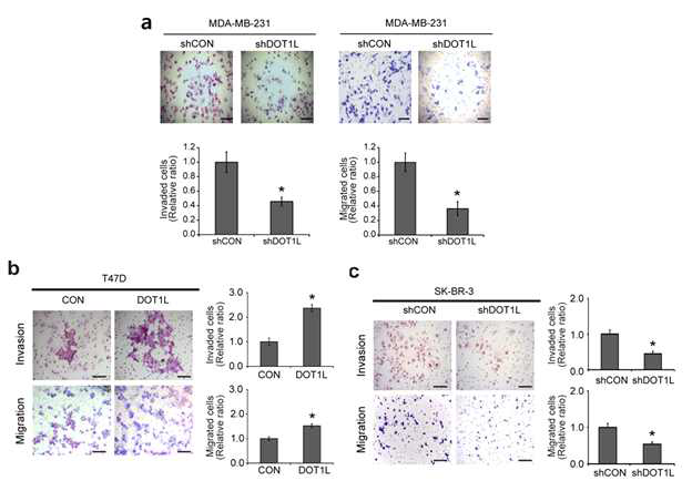 Dot1L발현에 따른 유방암 세포주의 침윤성과 이동성 확인
