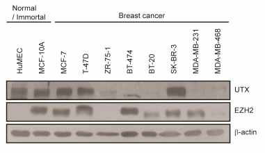 유방암 세포주에서 UTX의 발현확인