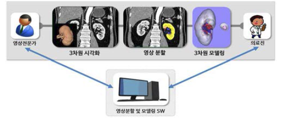 영상모델전문가와 의료진의 협업을 통한 영상분할