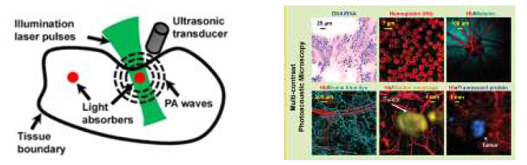 광음향 효과의 모식도 (왼쪽) 및 광음향 이미징을 활용한 예 (오른쪽)