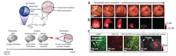 광음향 이미징과 SERS, MRI 현상을 접목하여 나노프로브를 외과적 수술에 이용할 수 있음을 보여주는 예