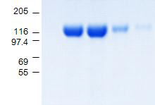 human Fc가 결합되어있는 재조합된 HER2 단백질을 발현 및 정제