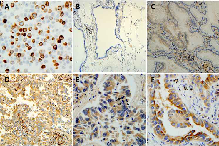 ROS1을 발현하고 있는 HEK 293T세포에 3B20-G1K 항체를 이용한 immunohistochemistry 결과