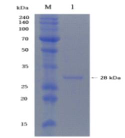 purification of recombinant small laccase from Planococcus donghaensis: Lane 1 represent the protein staining bands of molecular markers and purified enzyme.