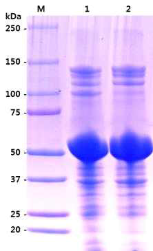 P66-I.B. extraction from recombinant E. coli cell by sonicator (lane 1) or lysozyme/DNaseI cell-lysis system