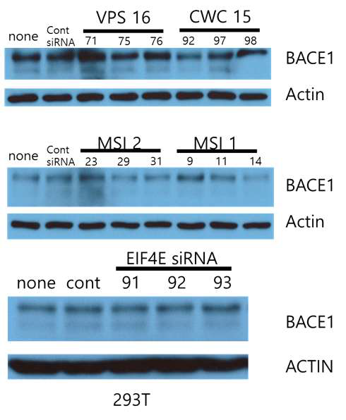 Evaluation of BACE-1 expression level using VPS16, CWC15, MSI1, MSI2 and EIF4E siRNAs