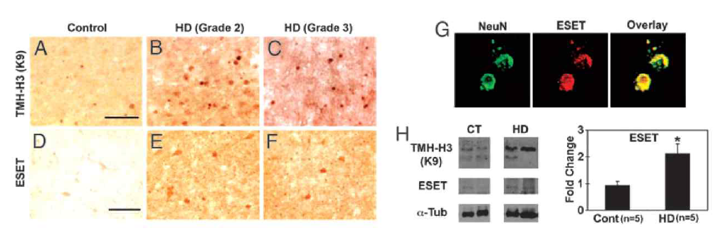 환자의 선조체 세포에서의 증가된 H3K9 삼중메틸화 (A-C)와 SETDB1(ESET) 발현 (D-F), Immunoreactivity of SETDB1 (G), Western blots (H)