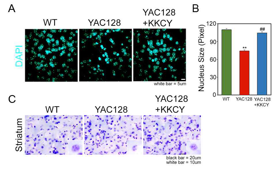 SETDB1/ESET inhibitor (KKCY01009) restores the size of neuronal nuclei in YAC128 mice