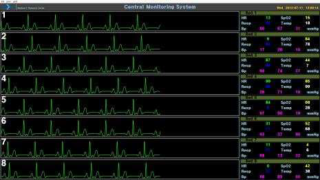 Multi-Patient 중앙 원격 모니터링 시스템 모듈(8명 모드)