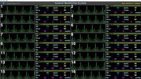 Multi-Patient 중앙 원격 모니터링 시스템 모듈(16명 모드)