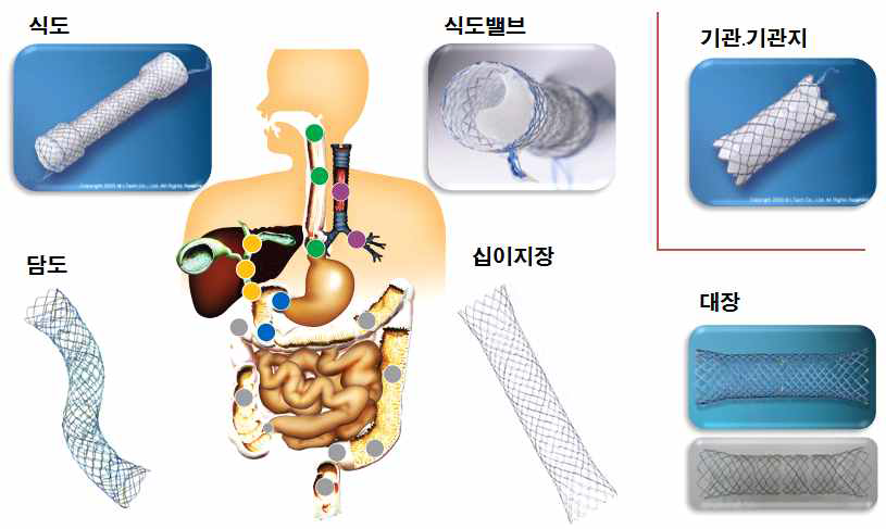 주요 소화기관용 스텐트 (GI stent)