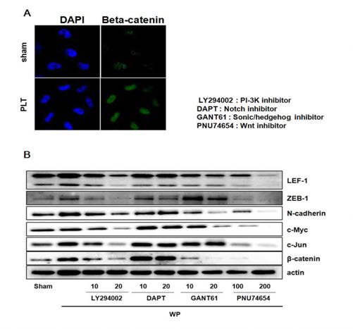 혈소판과 종양세포의 상호작용에 PI3K 및 Cancer stem cell pathway inhibitor가 미치는 영향