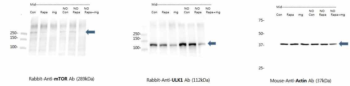 산화질소(NO)를 과 발현에 의한 mTOR-ULK-1 작용기작 관련 단백질의 변화확인