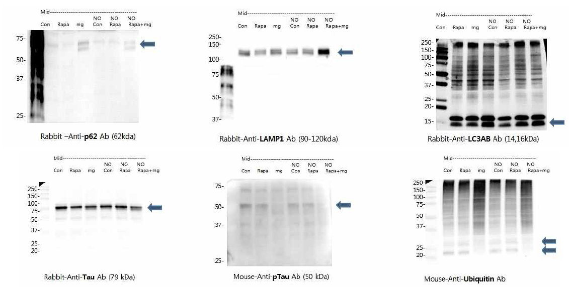 산화질소(NO)를 과 발현에 의한 자가소화작용(Autophagy) 관련 단백질의 변화