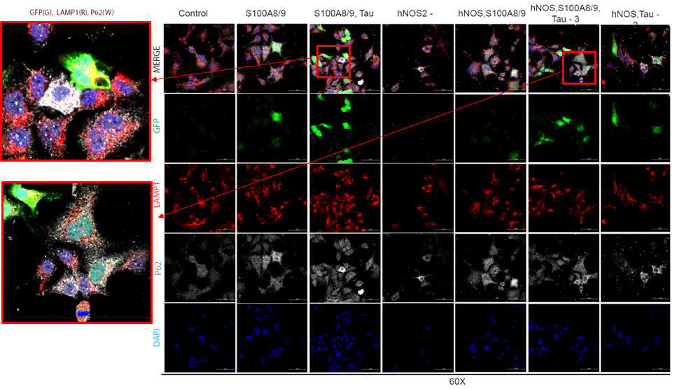 hNOS2, S100A8/9, Tau을 함께 형질주입(transfection)시킨 HEK293 세포의 GFP-Tau, LMAP1, P62 염색을 통해 변화 확인