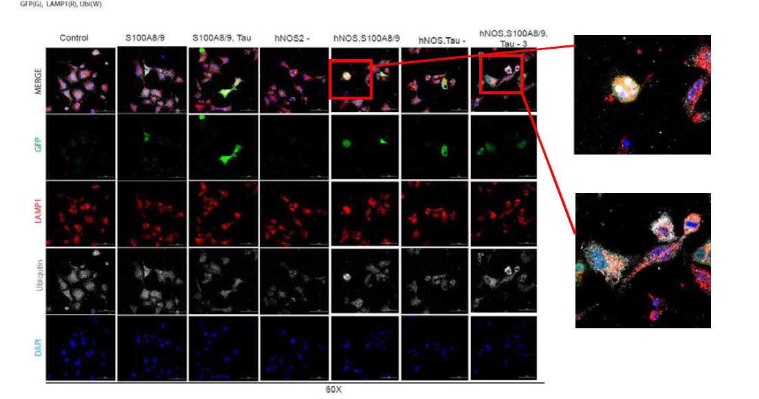 hNOS2, S100A8/9, Tau을 함께 형질주입(transfection)시킨 HEK293 세포의 GFP-Tau, LMAP1, Ubiquitin 염색을 통해 변화 확인