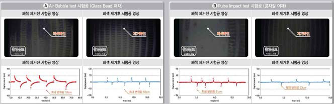 폐색제거 전, 후 비교