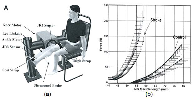 비복근의 경직을 정량적으로 평가하기 위한 연구 (a) 발목 및 무릎 관절에 힘을 가해주고 가해준 힘과 관절의 움직임을 측정하는 실험 장치, (b) 뇌졸중 환자 (stroke)와 정상인 (control)의 비복근 근섬유 길이-힘 측정 결과 비교