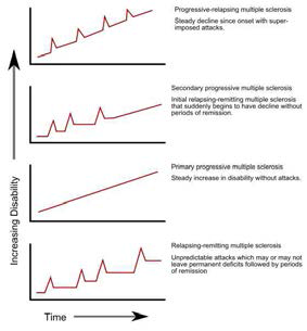 다발성 경화증의 유형
