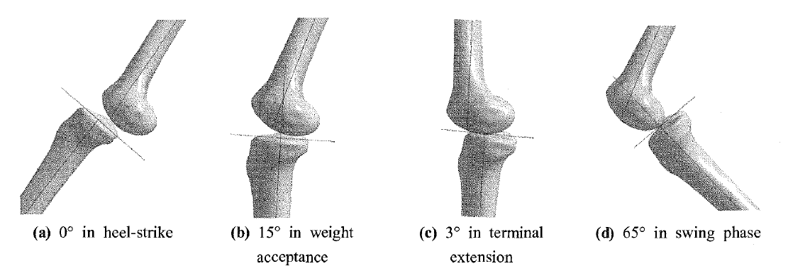 Tibio-femoral movement with flexion angles in the active condition (walking)