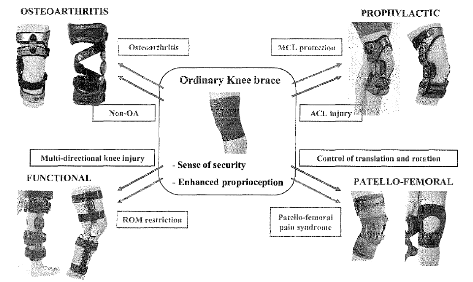 무릎보조기의 분류와 형태