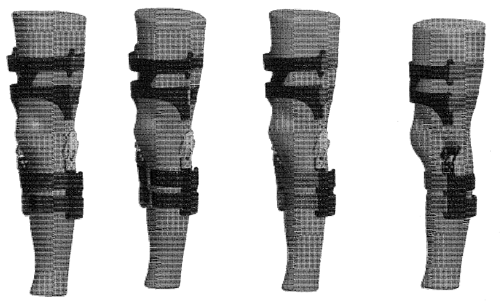 해부학적으로 일치하는 Knee brace Assembly