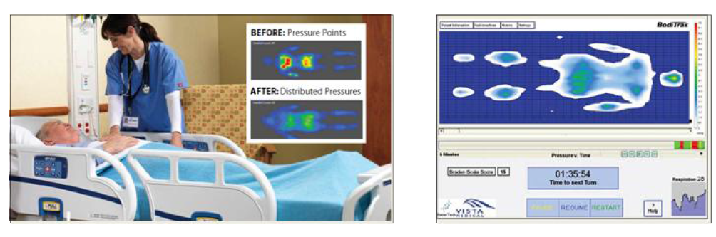 Vista Medical 社의 환자 모니터링용 스마트 매트(BodiTrak Smart Bed) 기술[26]