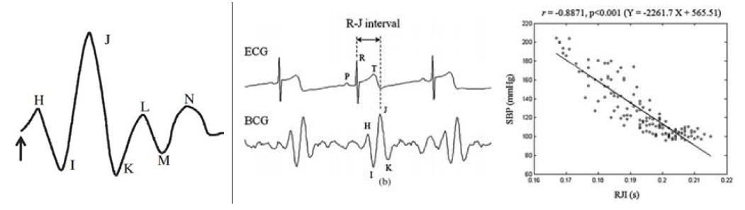 심탄도 신호의 특징점 및 심전도와의 상관관계 분석 결과