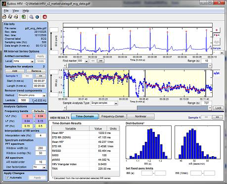 Kubios HRV 분석 툴 예시 – 시간영역 분석[34]