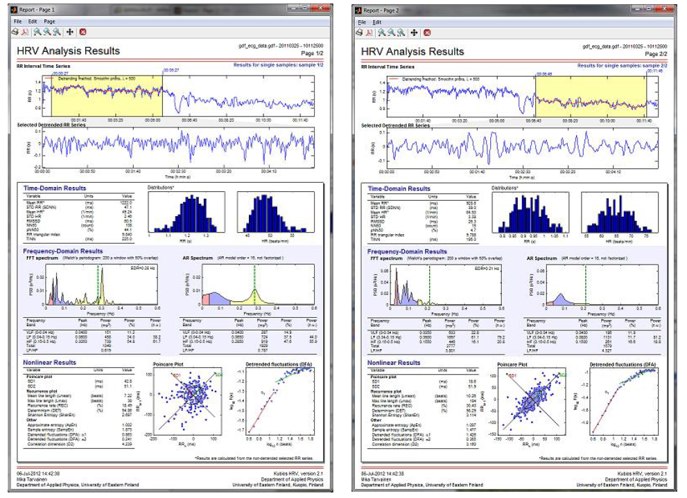 Kubios HRV 분석 툴 예시 – 결과 페이지[34]