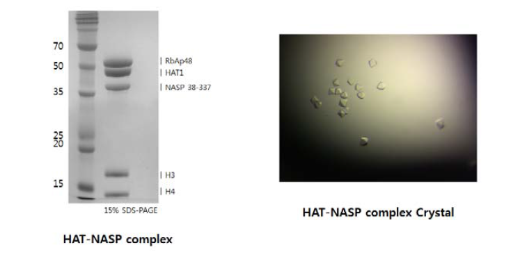 NASP-HAT-Histone 복합체 및 그 단백질 결정