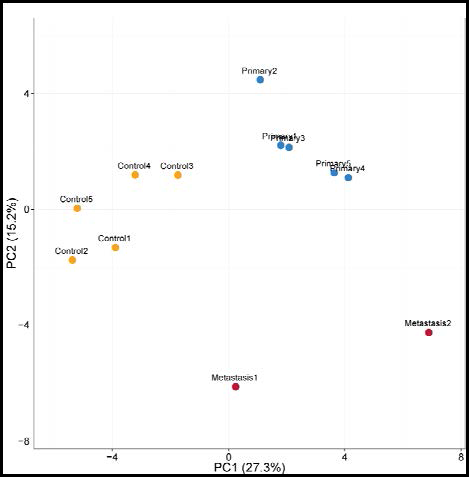 PCA plot for 16S rRNA sequencing data