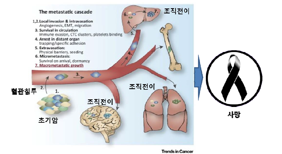 Metastasis 의 단계