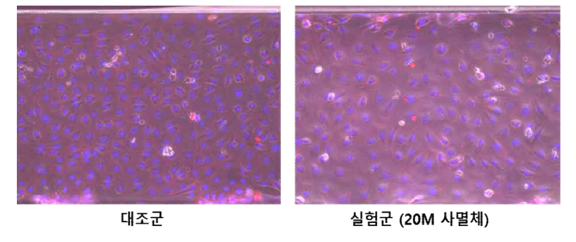 형광 바이오마커를 이용한 혈관벽 투과성 확인