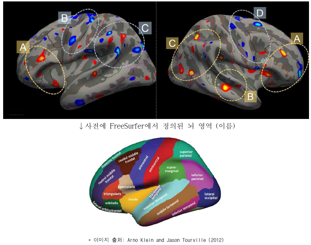 일반인군과 게임과몰입자군의 대뇌 피질 두께의 차이 (uncorrected P < 0.001)