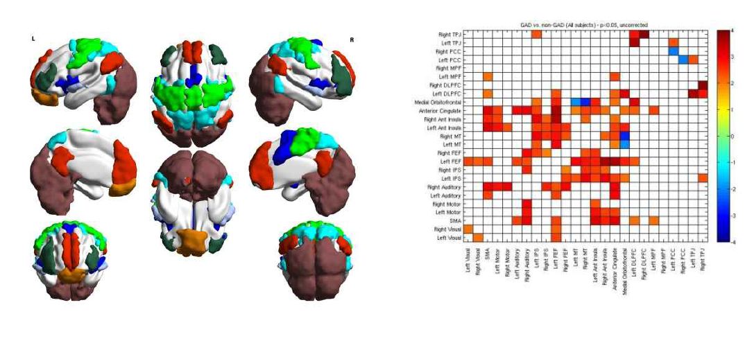 Resting-state fMRI 지역간의 연결성 분석 결과