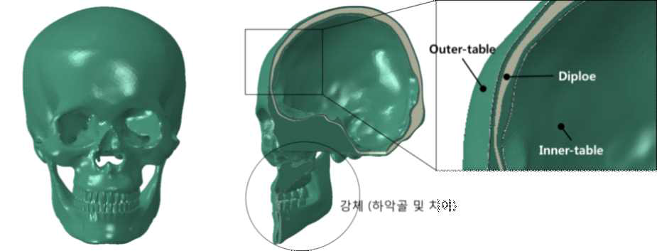 세겹의 뼈 층으로 개발된 대퇴골 유한요소 모델